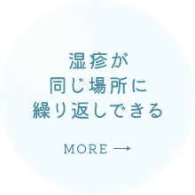 湿疹が同じ場所に繰り返しできる